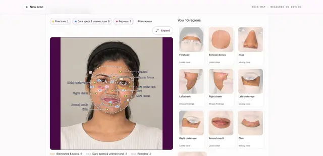 Skin map from the real app